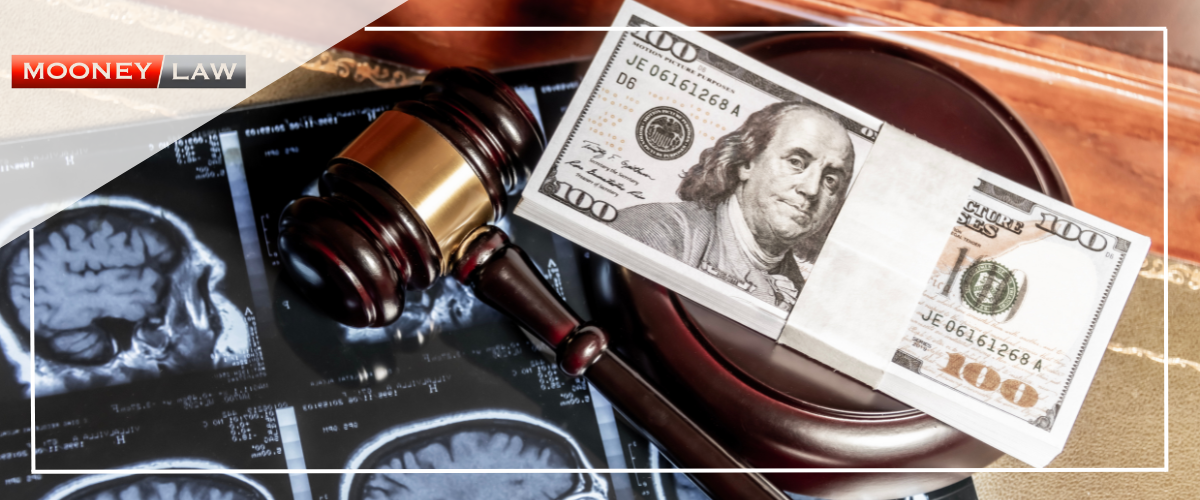 How Do I Know if I Qualify for a Personal Injury Settlement