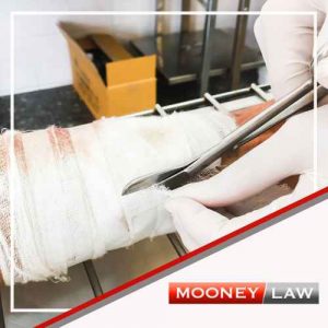 Dog Bite Injury Lawyer